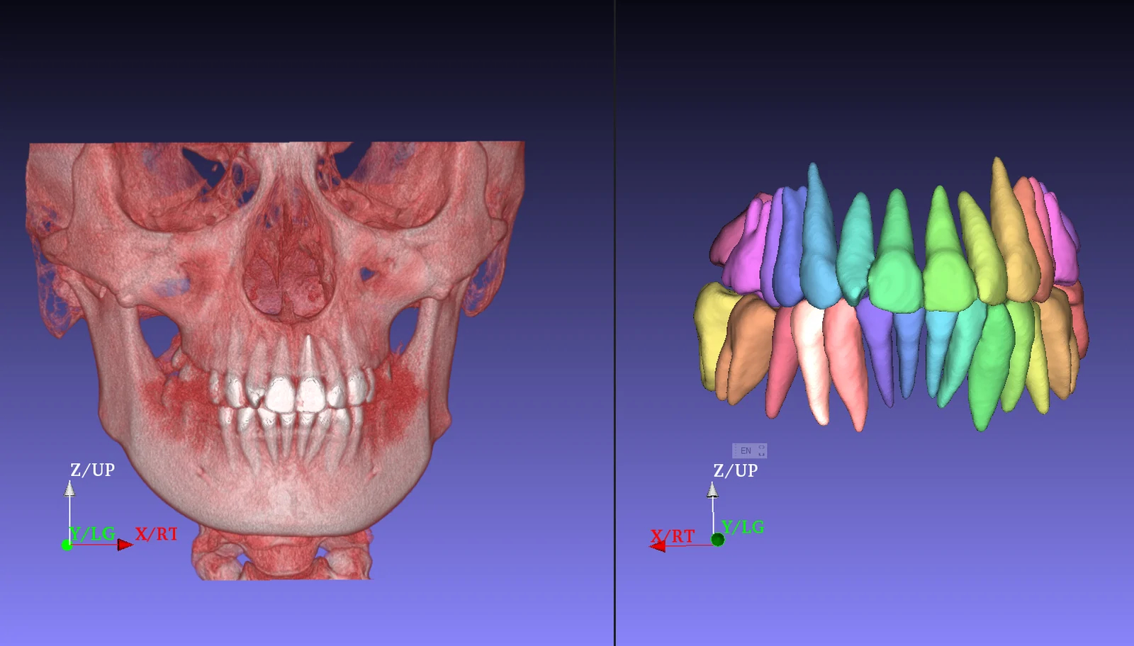 CBCT Segmentation screenshot
