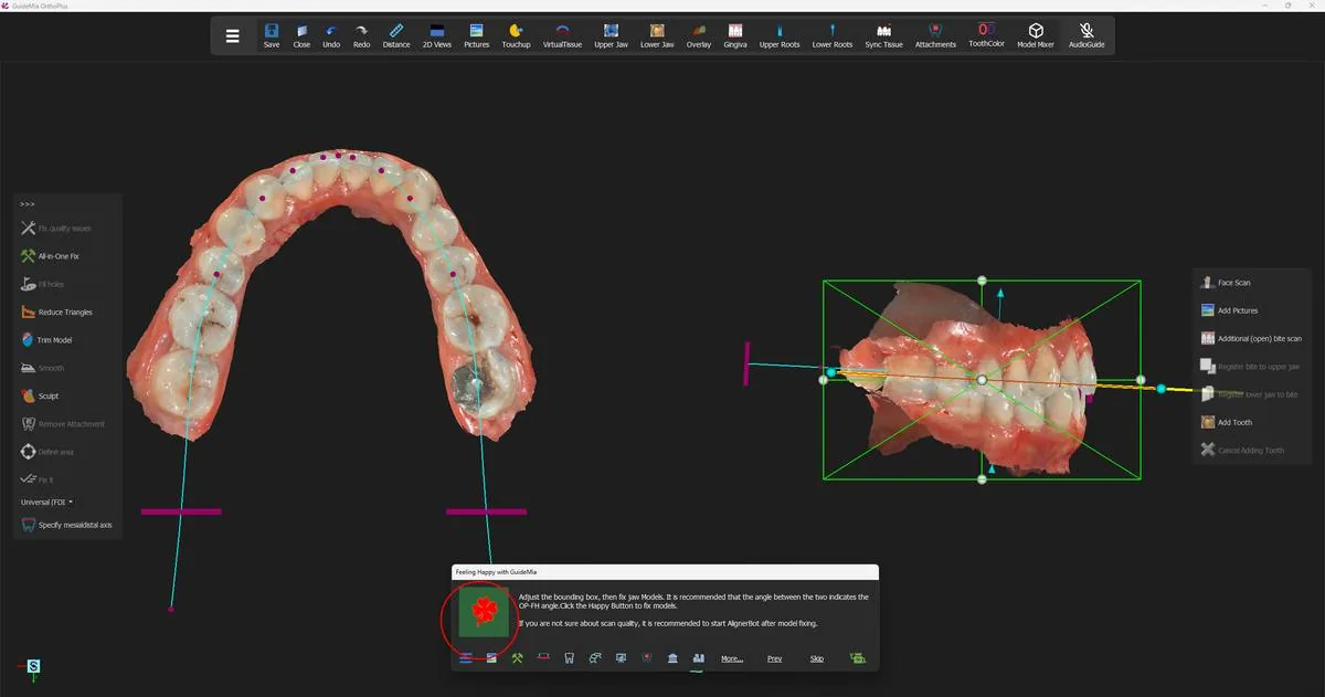 The bounding box on the models in the assembly window, with the occlusal plane still drawn through them.