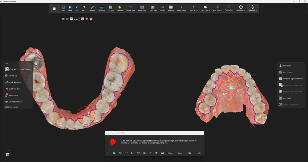 Both arches with the aligner boundary extracted — one continuous loop per jaw, following the gingival margin of every crown.
