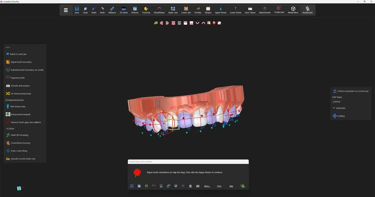 Middle-clicking the blue arrow on a tooth brings up its bounding box and rotation handle.