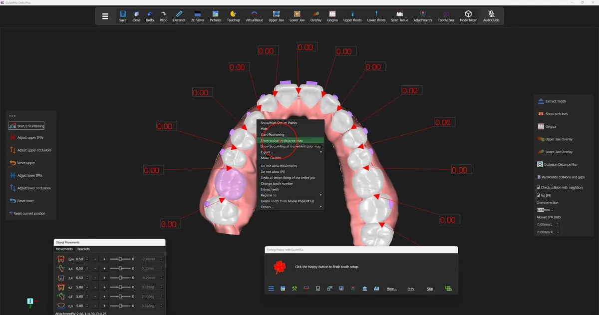 The right-click menu on a tooth, with the two map items above "Export ...".