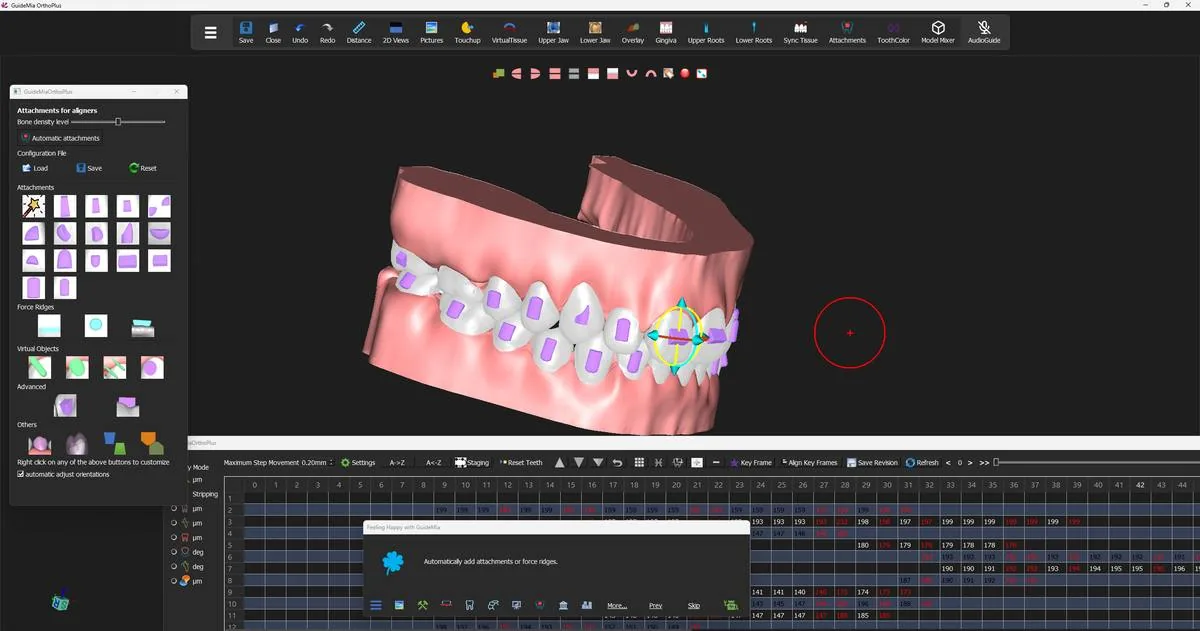 The same set checked from the side, with the model turned to bring the posterior teeth into view.