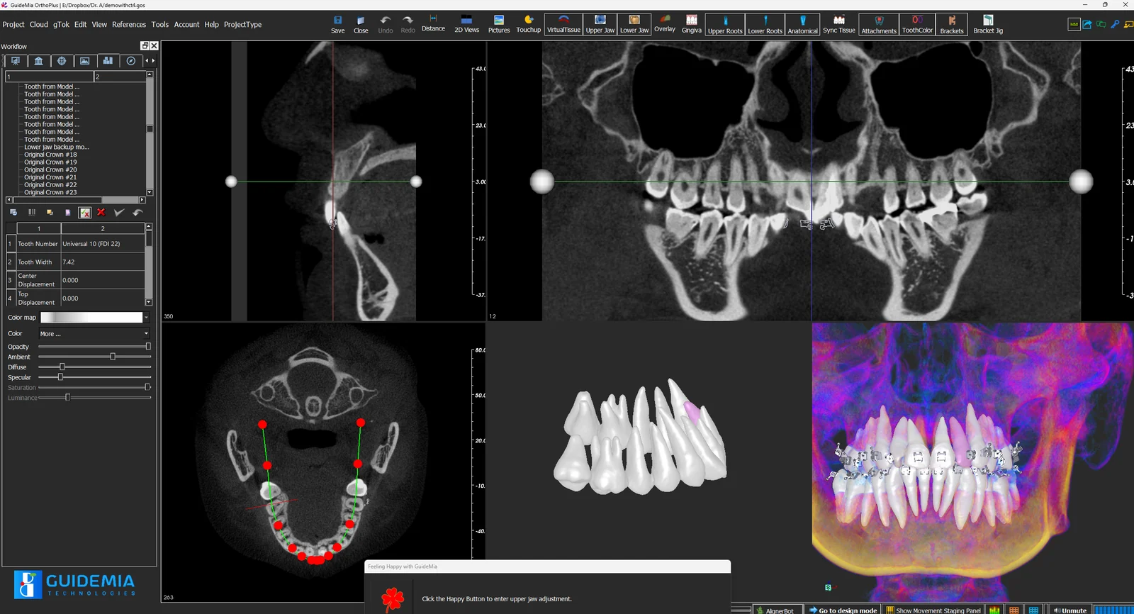 GuideMia OrthoPlus screenshot